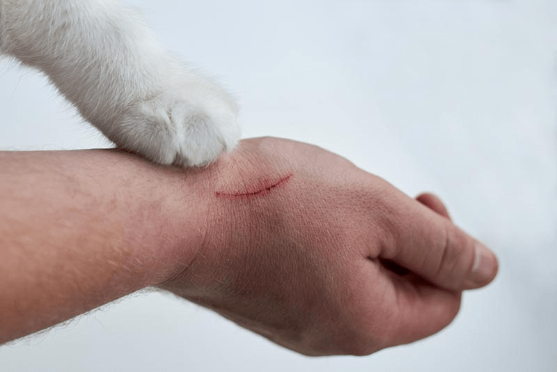 Kedi Tırmaladı Ne Yapmalıyım?